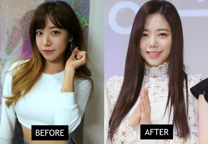 Gương mặt của Namjoo trở nên khác biệt qua hai bức ảnh. 