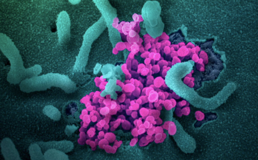 Các nhà nghiên cứu tin rằng virus gây ra Covid-19 tiếp tục biến đổi trong quá trình lây lan. (Ảnh: SCMP)