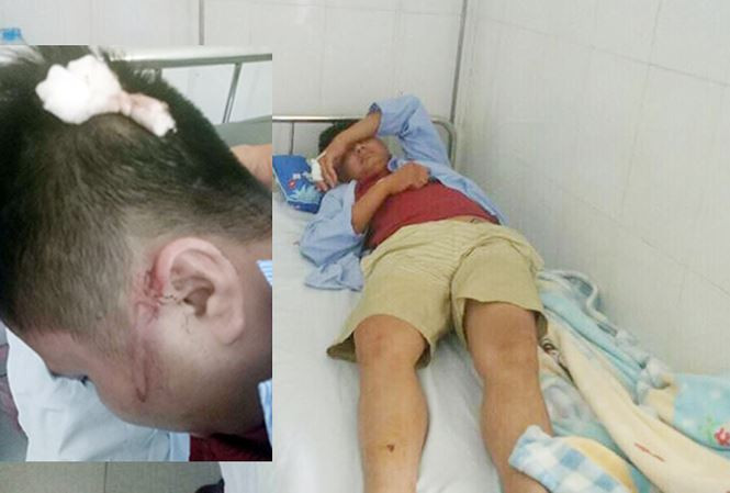 Anh Yên và anh Công nhập viện sau khi bị truy sát