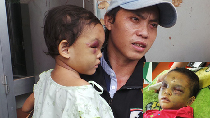 Anh Tố đến Bệnh viện Đa khoa Bình Dương sau khi nghe thông tin cháu Ngân bị bạo hành. Ảnh: Nguyên Hưng