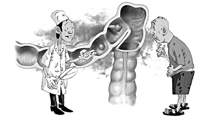 Viêm đại tràng - Điều trị ngay khi có dấu hiệu