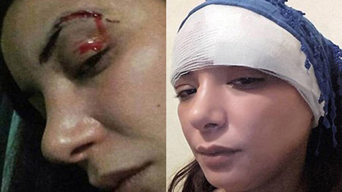 Loubna Abidar chia sẻ hình mình bị đánh lên trang cá nhân.