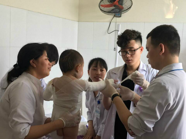 Bác sĩ thay băng cho bệnh nhi. Ảnh: Bệnh viện cung cấp.