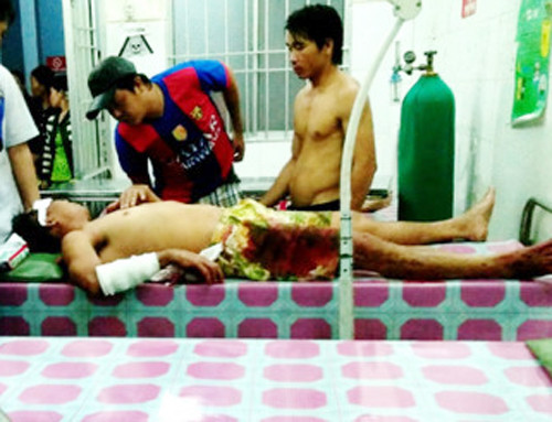 Người chồng bị nhiều vết thương ở tay và đầu do vợ chém. Ảnh: Phúc Hưng