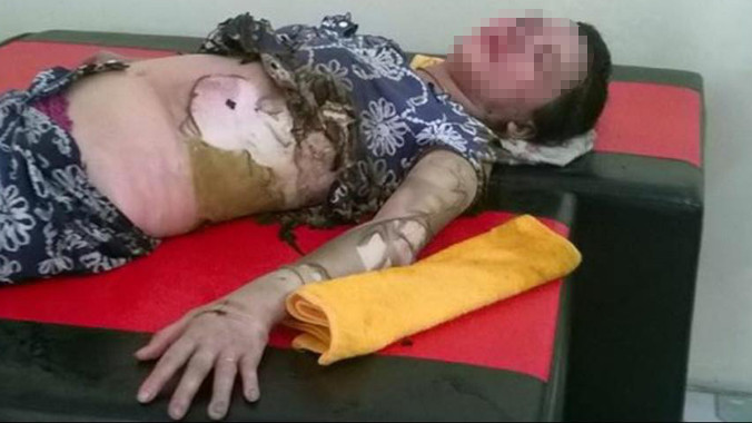 Chị P đang cấp cứu tại bệnh viện. Ảnh: Hiền Bình.