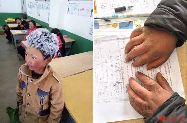 Mái tóc đóng băng trắng xóa và bàn tay nứt nẻ, đỏ ửng của một học sinh lớp 3 ở Trung Quốc sau khi đi bộ tới trường trong cái rét kỷ lục.