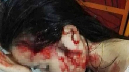 Nạn nhân Phan Thị Hồng Ngọc bị cô giáo Phương và đồng bọn đánh chảy máu.
