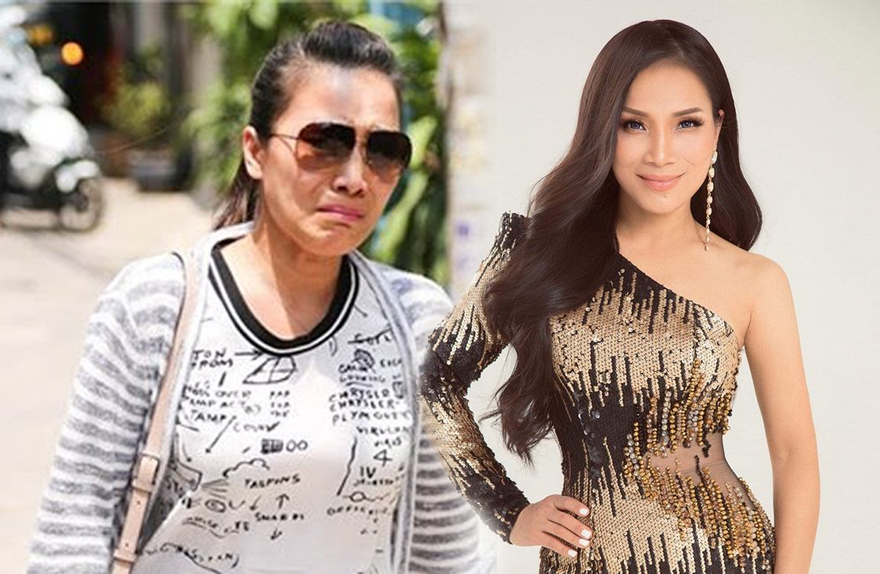 Hồng Ngọc chia sẻ sức khoẻ hiện tại sau bị bỏng nặng vì nổ nồi xông hơi 