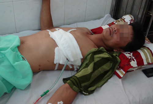 Bệnh nhân Thái đang điều trị tại Bệnh viện Đa khoa Bình Phước. Ảnh: Chế Bắc.