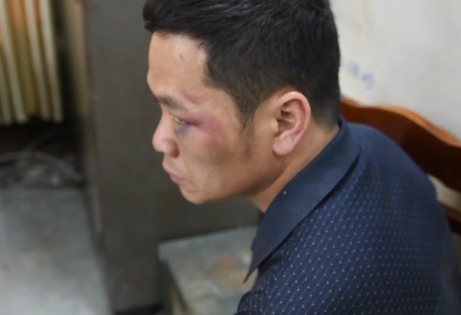 Tài xế Lục Thanh Đồng. Ảnh: CAND