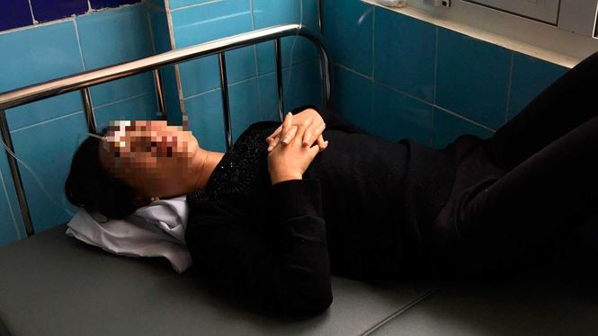 Chị Nguyễn Thị Hằng bị mẹ chồng Lê Thị An tạt axít. 