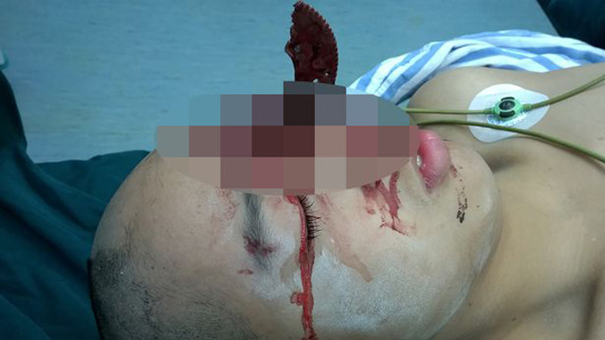 Hình ảnh Zheng Lang lúc vừa nhập viện.