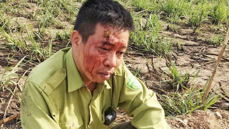 Anh Nhật bị ném gậy tre trúng đầy gây thương tích