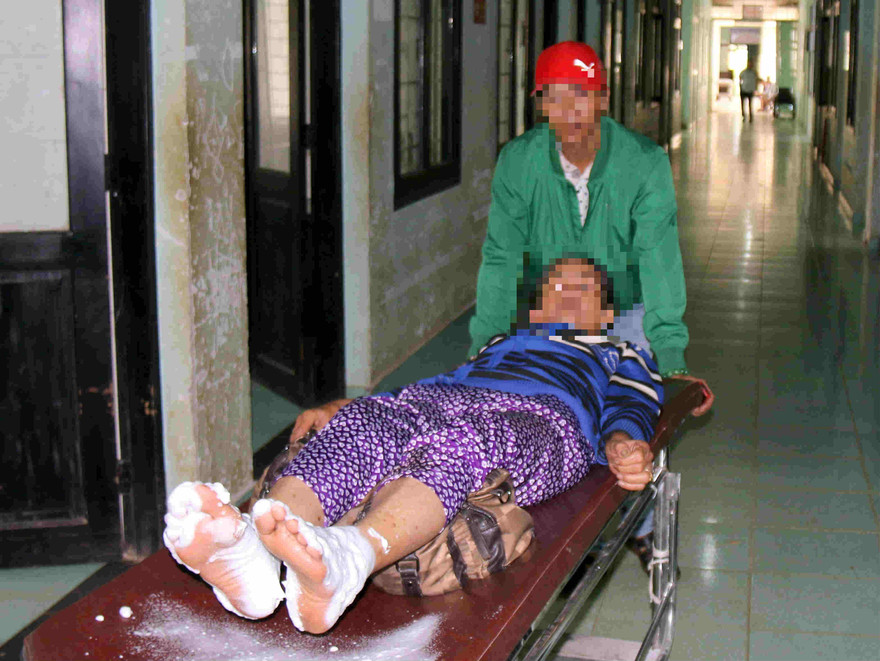 Vụ tẩm xưng tự thiêu khiến nhiều người bị bỏng nặng