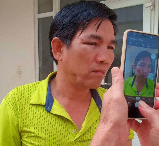 Ông Thủy tố cáo bị Chánh văn phòng Huyện ủy Tuy Đức đánh