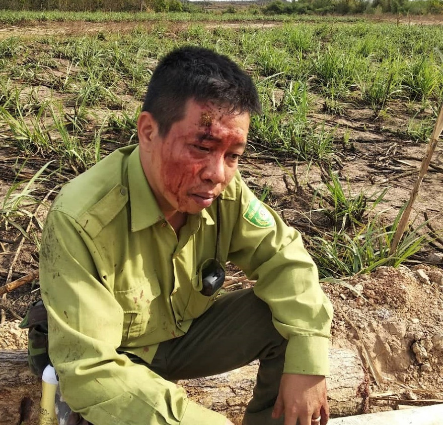 Ông Ngô Lê Nhật Tiến - Trạm phó Trạm Kiểm lâm số 7 bị lâm tặc tấn công