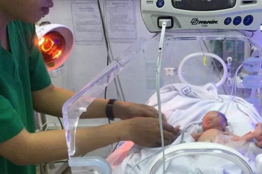 Đây là trường hợp sinh non thứ 2 tại BV Quận Thủ Đức từ đầu năm đến nay.
