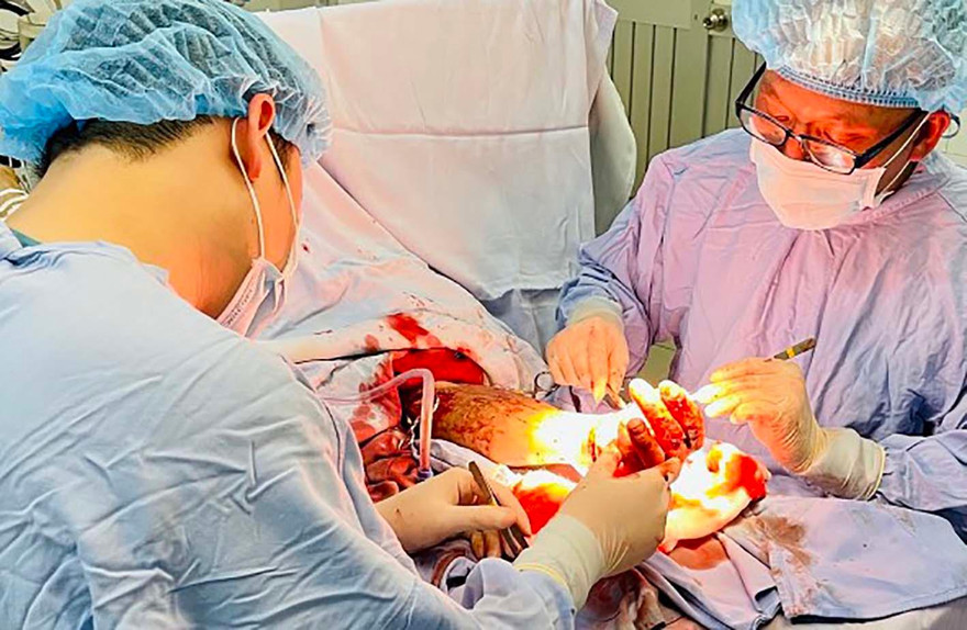 Ca mổ nối bàn tay cho anh N.Đ.P 