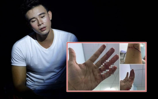 Đông Hùng và bàn tay bị chém rách khiến nhiều người xôn xao.