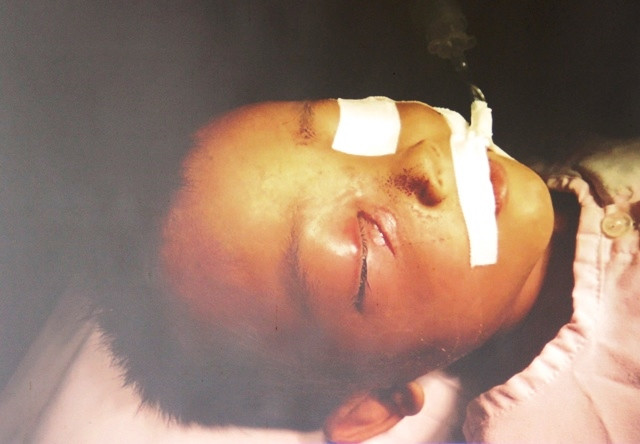 Bé L lúc vào cấp cứu tại Bệnh viện Nhi đồng 1 TPHCM. Ảnh do bệnh viện cung cấp.