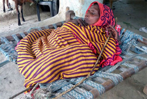 Chứng bệnh lạ khiến bà Shanti thường xuyên sống trong cảnh đau nhức toàn thân. Ảnh: Caters.