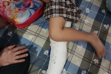 Học sinh gãy chân trong trường: Hiệu trưởng vô cảm?