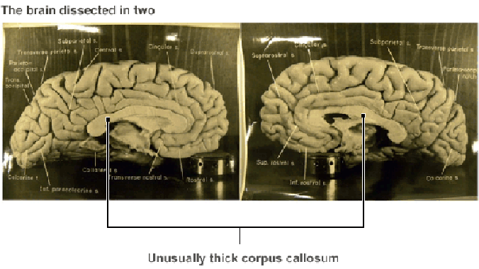 Mô tả phần vỏ não Albert Einstein trong nghiên cứu của Dean Falk năm 2013. Ảnh: BBC.