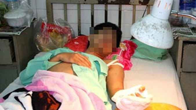 Nam thanh niên tự chặt đứt cánh tay do tiếng nói bên tai xúi giục. Ảnh: Thiên Chương/ Ngoisao.net