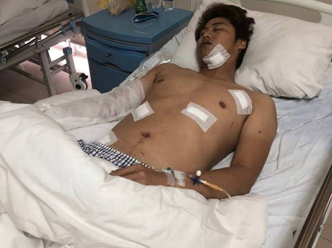 Ông Quý bị chém nhiều nhát phải nhập viện cấp cứu