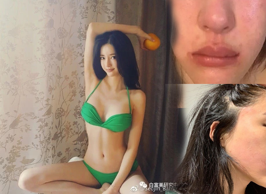 'Bản sao 19 tỷ' của AngelaBaby tố bị CEO bạo hành sưng bầm mặt