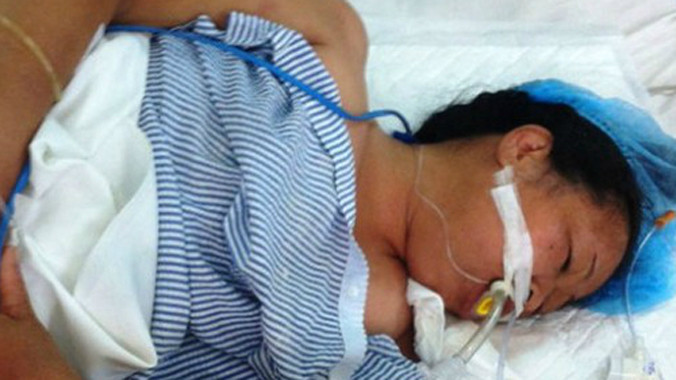 Bệnh nhân điều trị tại Trung tâm chống độc Bạch Mai. Ảnh: L.A.