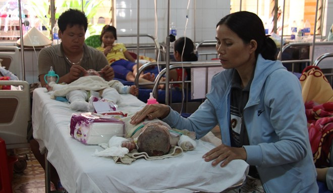 Hai cháu nhỏ bị bỏng nặng điều trị tại bệnh viện. Ảnh: M. Q