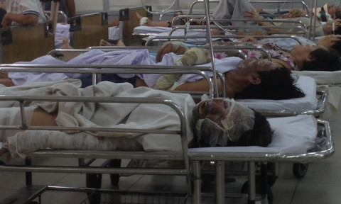 Cả hai bị phỏng nặng đang được điều trị tại Chợ Rẫy