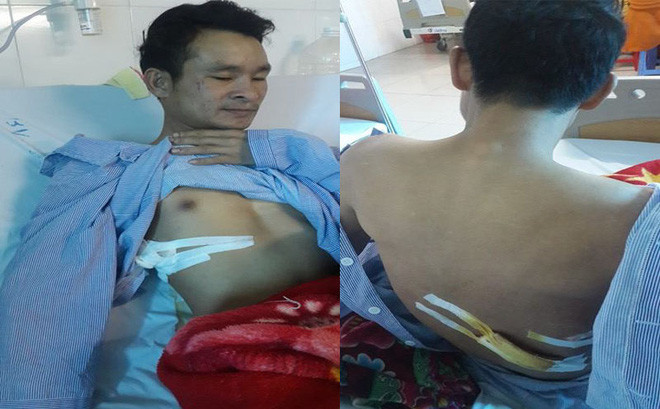 Anh Sơn đang được điều trị tại bệnh viện