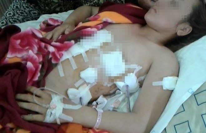 Chị Na được điều trị tại bệnh viện. Ảnh: Gia đình cung cấp