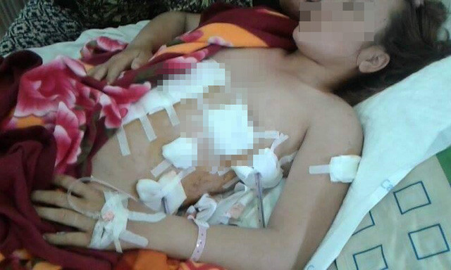 Chị Na nghi bị tình nhân của chồng đâm gần chục nhát dao vào người. Ảnh nhân vật cung cấp