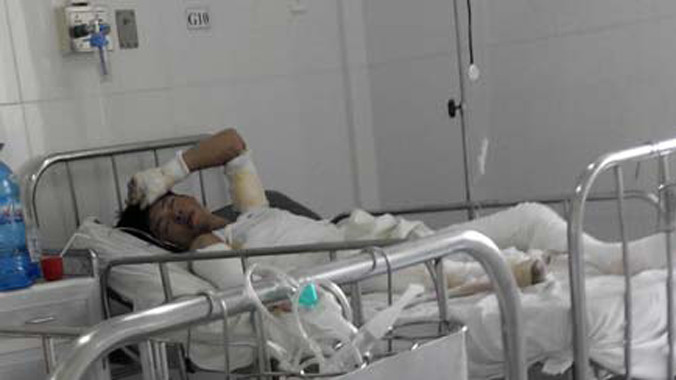 Nạn nhân Bình đang được chữa trị tại Khoa Bỏng, Bệnh viện Chợ Rẫy.