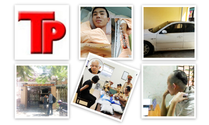 Bản tin Hình sự 18H: Côn đồ lao vào nhà đánh gãy cả 2 chân người dân