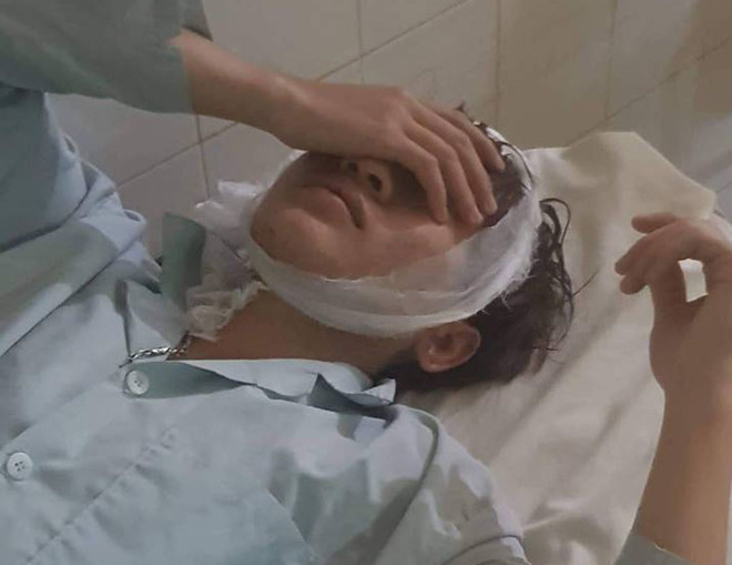 1 trong 6 thanh niên bị chém khi uống cà phê