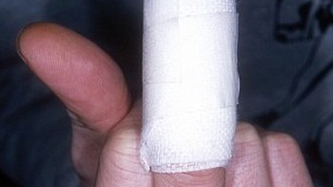 Kiện đòi bồi thường 2 triệu tỷ tỷ tỷ USD vì bị chó cắn