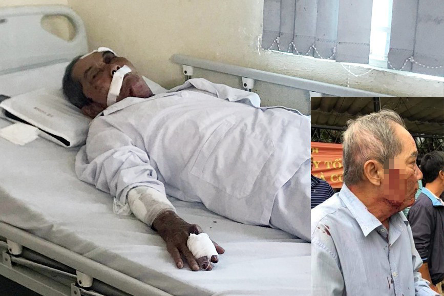 Ông Lâm bị đánh đang được điều trị trong bệnh viện.