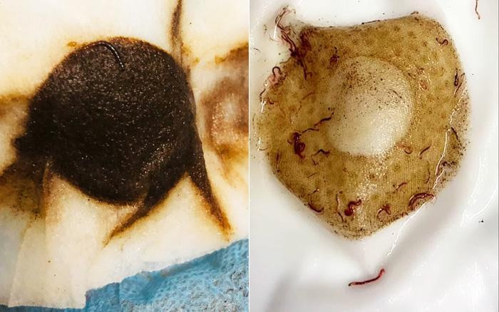 Giun sán xuất hiện trong nước sinh hoạt của cư dân KĐT Pháp Vân - Tứ Hiệp