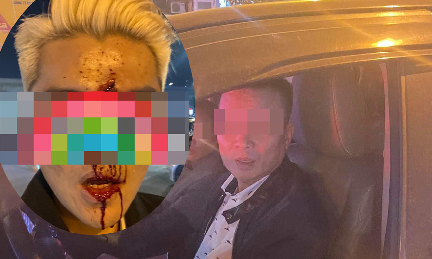 Nam thanh niên bị đánh và tài xế xe bán tải.