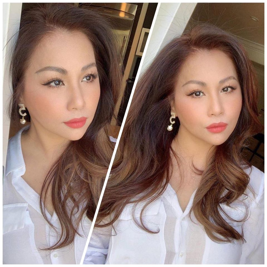 Hình ảnh mới nhất của Minh Tuyết bị chê thẩm mỹ tới mức không nhận ra. 