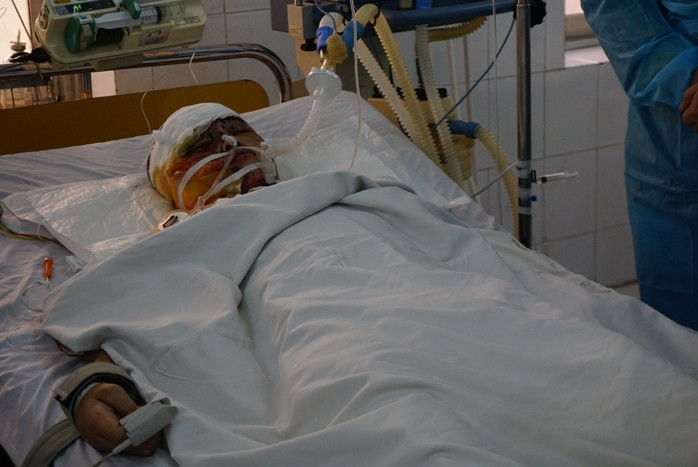 Chị Lệ vẫn đang hôn mê. ( Ảnh chụp ngày 25/3).