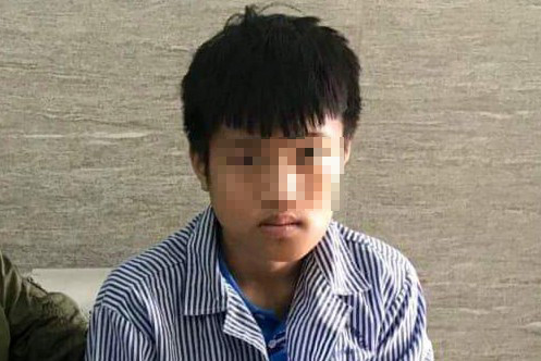 Nam sinh H.C.Kh. được chẩn đoán bị gãy xương hàm dưới bên trái