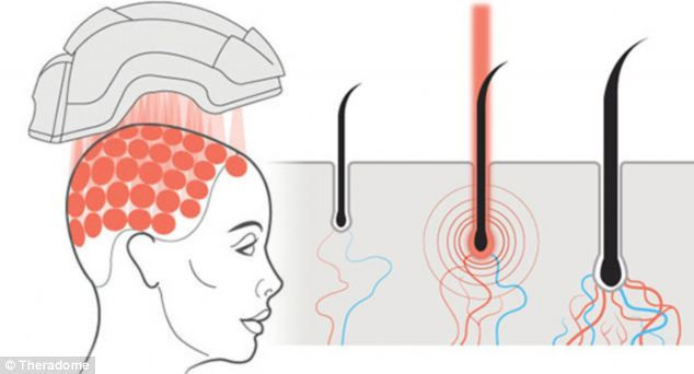 Mũ bảo hiểm giúp mọc tóc