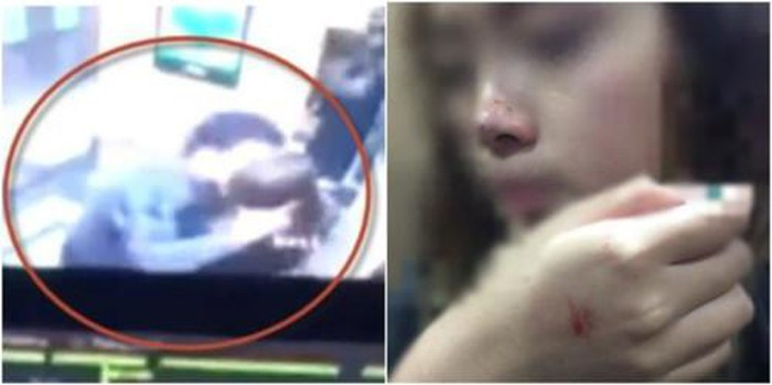 Nạn nhân trước và sau khi bị cưỡng hôn trong thang máy