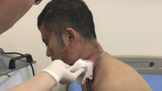 Ba công nhân bị nhóm côn đồ dùng dao tấn công vùng cổ