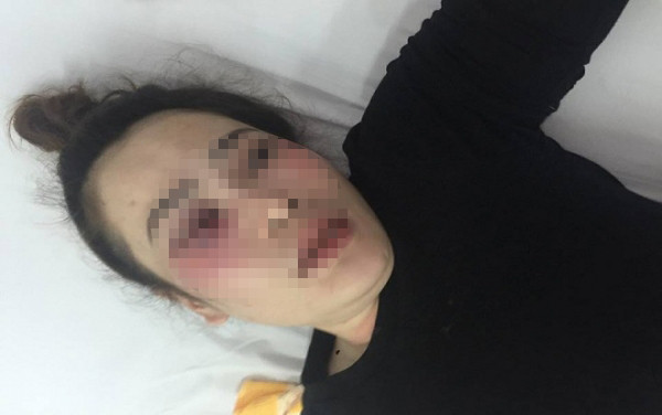 Chị Như đang được điều trị tại bệnh viện